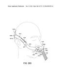 PATIENT INTERFACE AND METHOD FOR MAKING SAME diagram and image