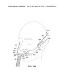 PATIENT INTERFACE AND METHOD FOR MAKING SAME diagram and image