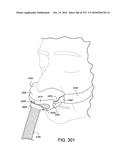 PATIENT INTERFACE AND METHOD FOR MAKING SAME diagram and image