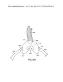 PATIENT INTERFACE AND METHOD FOR MAKING SAME diagram and image