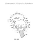 PATIENT INTERFACE AND METHOD FOR MAKING SAME diagram and image