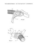 PATIENT INTERFACE AND METHOD FOR MAKING SAME diagram and image