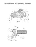 PATIENT INTERFACE AND METHOD FOR MAKING SAME diagram and image