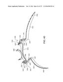 PATIENT INTERFACE AND METHOD FOR MAKING SAME diagram and image