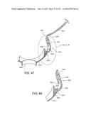 PATIENT INTERFACE AND METHOD FOR MAKING SAME diagram and image