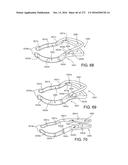 PATIENT INTERFACE AND METHOD FOR MAKING SAME diagram and image