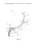 PATIENT INTERFACE AND METHOD FOR MAKING SAME diagram and image