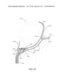 PATIENT INTERFACE AND METHOD FOR MAKING SAME diagram and image