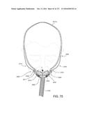 PATIENT INTERFACE AND METHOD FOR MAKING SAME diagram and image