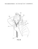 PATIENT INTERFACE AND METHOD FOR MAKING SAME diagram and image