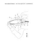 PATIENT INTERFACE AND METHOD FOR MAKING SAME diagram and image