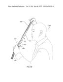 PATIENT INTERFACE AND METHOD FOR MAKING SAME diagram and image