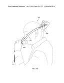 PATIENT INTERFACE AND METHOD FOR MAKING SAME diagram and image