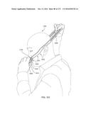 PATIENT INTERFACE AND METHOD FOR MAKING SAME diagram and image