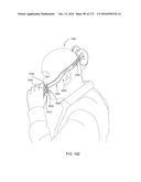 PATIENT INTERFACE AND METHOD FOR MAKING SAME diagram and image