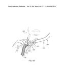 PATIENT INTERFACE AND METHOD FOR MAKING SAME diagram and image