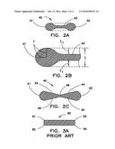 INTRODUCER SHEATH HAVING PROFILED REINFORCING MEMBER diagram and image