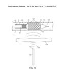 ADJUSTABLE-LENGTH DRUG DELIVERY BALLOON diagram and image