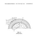 SYSTEMS, METHODS AND DEVICES FOR A SKULL/BRAIN INTERFACE diagram and image