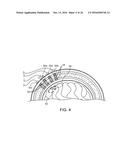 SYSTEMS, METHODS AND DEVICES FOR A SKULL/BRAIN INTERFACE diagram and image