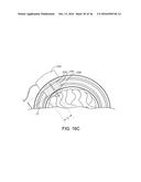 SYSTEMS, METHODS AND DEVICES FOR A SKULL/BRAIN INTERFACE diagram and image