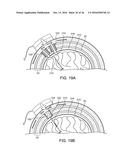 SYSTEMS, METHODS AND DEVICES FOR A SKULL/BRAIN INTERFACE diagram and image