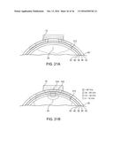 SYSTEMS, METHODS AND DEVICES FOR A SKULL/BRAIN INTERFACE diagram and image