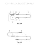 BRAIDED LEAD WITH EMBEDDED FIXATION STRUCTURES diagram and image