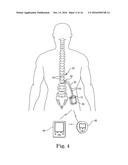 BRAIDED LEAD WITH EMBEDDED FIXATION STRUCTURES diagram and image