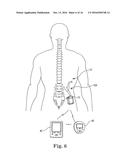 BRAIDED LEAD WITH EMBEDDED FIXATION STRUCTURES diagram and image