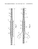 BRAIDED LEAD WITH EMBEDDED FIXATION STRUCTURES diagram and image