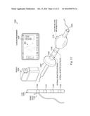 IPG CONFIGURED TO DELIVER DIFFERENT PULSE REGIMES TO DIFFERENT LEADS FOR     PUDENDAL NERVE STIMULATION diagram and image