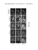 EPHA3 AND MULTI-VALENT TARGETING OF TUMORS diagram and image