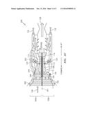 ENGINE BYPASS VALVE diagram and image