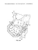 Compressor Intake Muffler And Filter diagram and image