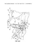 Compressor Intake Muffler And Filter diagram and image