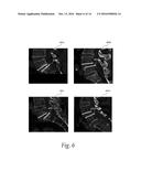 Patient Management Based On Anatomic Measurements diagram and image