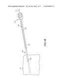 LEAD INSERTION DEVICES AND ASSOCIATED SYSTEMS AND METHODS diagram and image