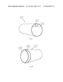 System and Methods for Removing Undesirable Material within a Circulatory     System Utilizing during a Surgical Procedure diagram and image