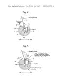 ENDOSCOPE PROVIDED WITH RAISING BASE diagram and image