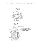 ENDOSCOPE PROVIDED WITH RAISING BASE diagram and image