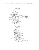 ENDOSCOPE PROVIDED WITH RAISING BASE diagram and image