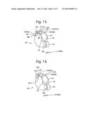 ENDOSCOPE PROVIDED WITH RAISING BASE diagram and image