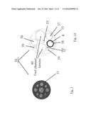 SUBSTANTIALLY RIGID AND STABLE ENDOLUMINAL SURGICAL SUITE FOR TREATING A     GASTROINTESTINAL LESION diagram and image