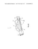 SUBSTANTIALLY RIGID AND STABLE ENDOLUMINAL SURGICAL SUITE FOR TREATING A     GASTROINTESTINAL LESION diagram and image