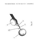 SUBSTANTIALLY RIGID AND STABLE ENDOLUMINAL SURGICAL SUITE FOR TREATING A     GASTROINTESTINAL LESION diagram and image