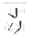 SUBSTANTIALLY RIGID AND STABLE ENDOLUMINAL SURGICAL SUITE FOR TREATING A     GASTROINTESTINAL LESION diagram and image