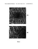 OPTICAL COHERENCE TOMOGRAPHY SYSTEM FOR HEALTH CHARACTERIZATION OF AN EYE diagram and image