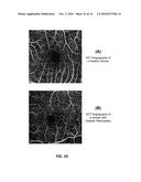 OPTICAL COHERENCE TOMOGRAPHY SYSTEM FOR HEALTH CHARACTERIZATION OF AN EYE diagram and image