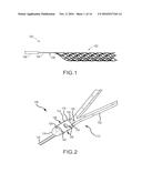 CONNECTION OF A MANIPULATION MEMBER, INCLUDING A BEND WITHOUT SUBSTANTIAL     SURFACE CRACKS, TO AN ENDOVASCULAR INTERVENTION DEVICE diagram and image